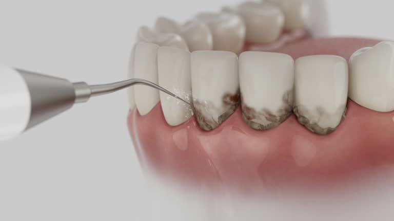 Trusted Teeth Cleaning And Checkup service in Fruitport, MI - Dentist Open Now